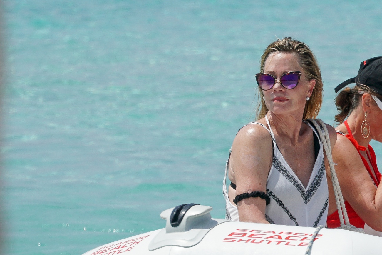 Su brazo estuvo desnudo durante un tiempo Su brazo estuvo desnudo durante un tiempo